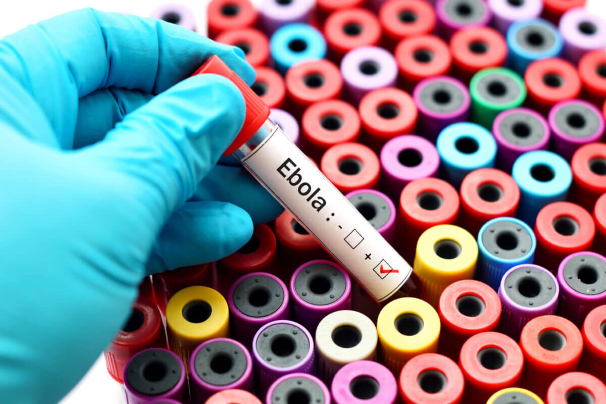 Blood sample positive with ebola virus
