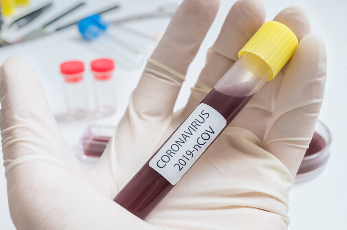 Hand of researcher holds test tube with blood for Coronavirus 2019-nCOV test.