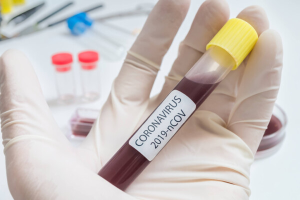 Coronavirus / COVID-19 blood test tube