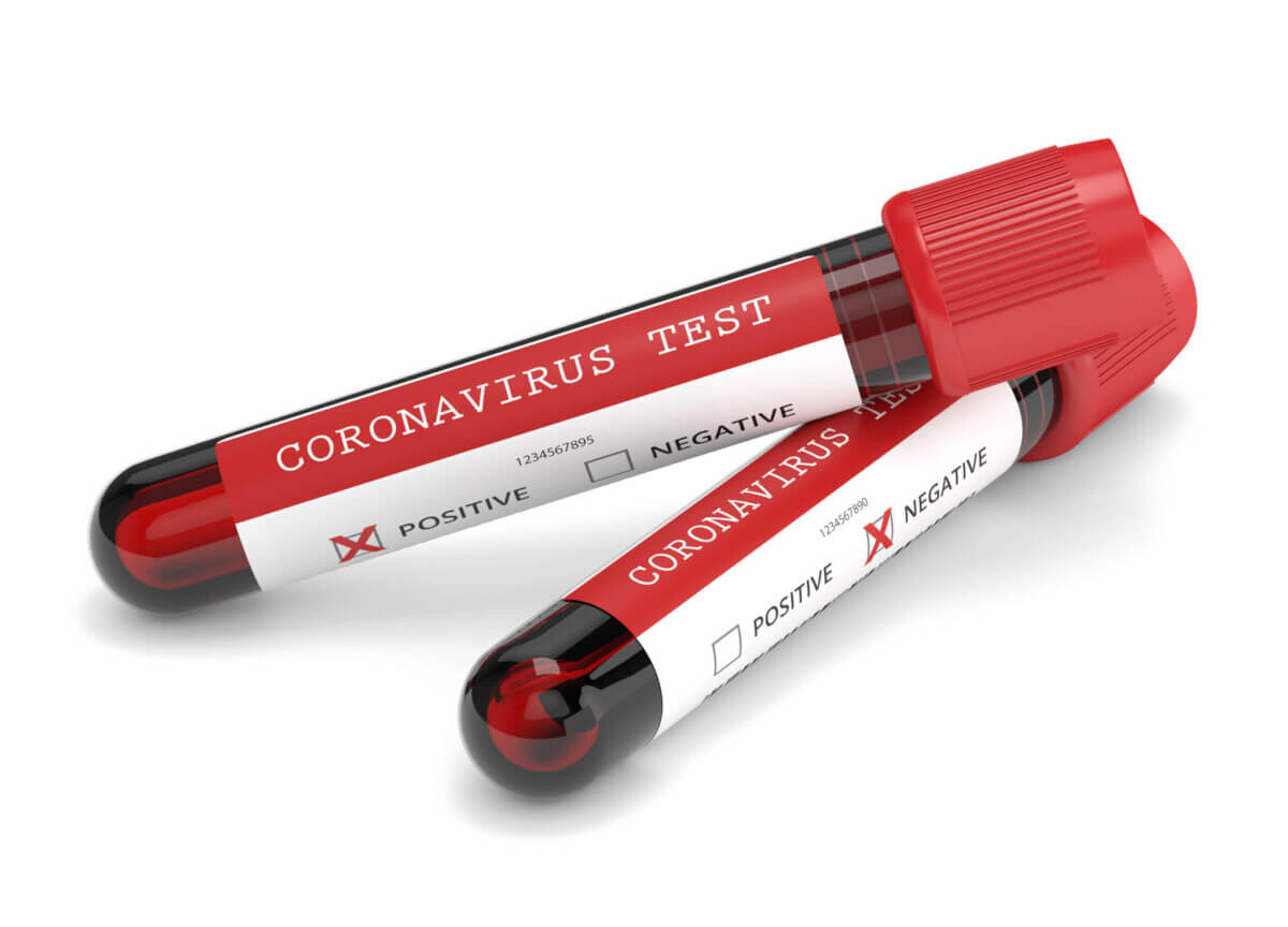 3d render of coronavirus 2019-nCoV blood samples