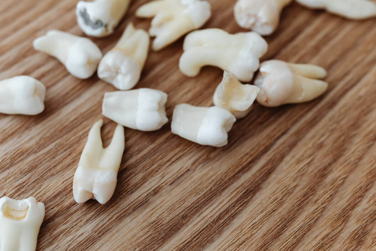 teeth tooth loss