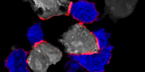 Immunofluorescent image depicting T cells (blue) attacking tumor