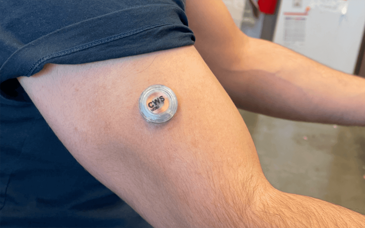 Wearable technology: health tracker on arm