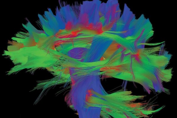 MRI-generated map of neural pathways in the brain