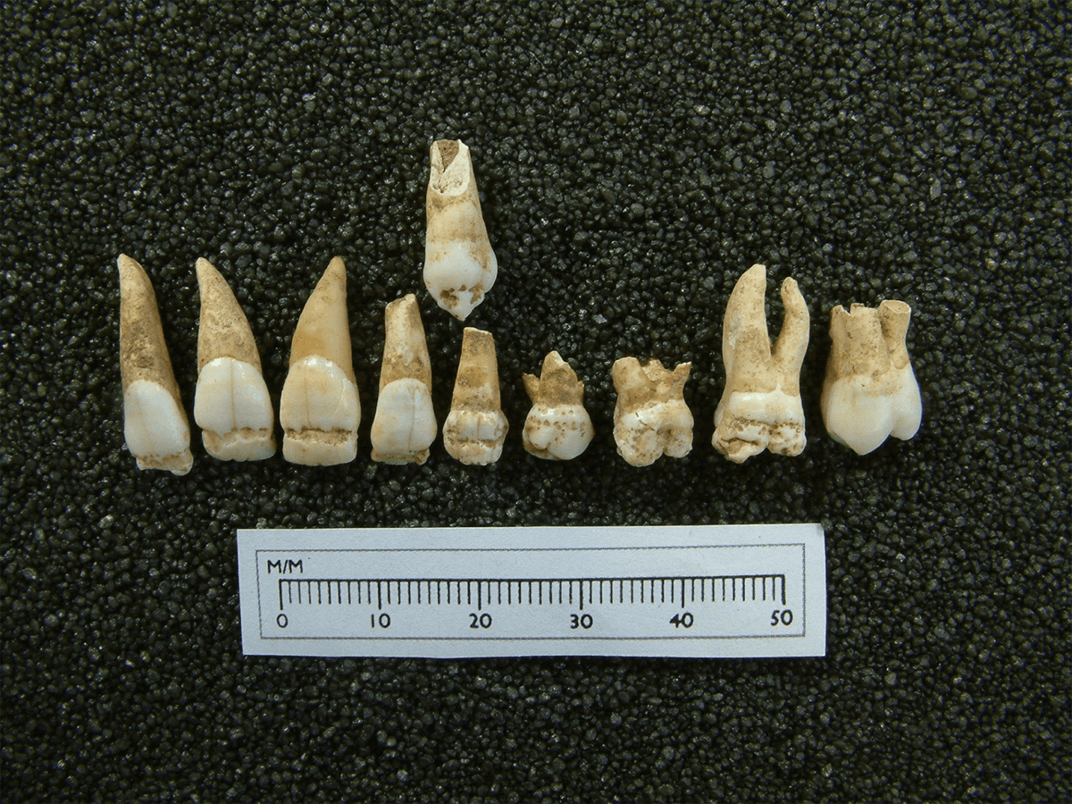 dental remains