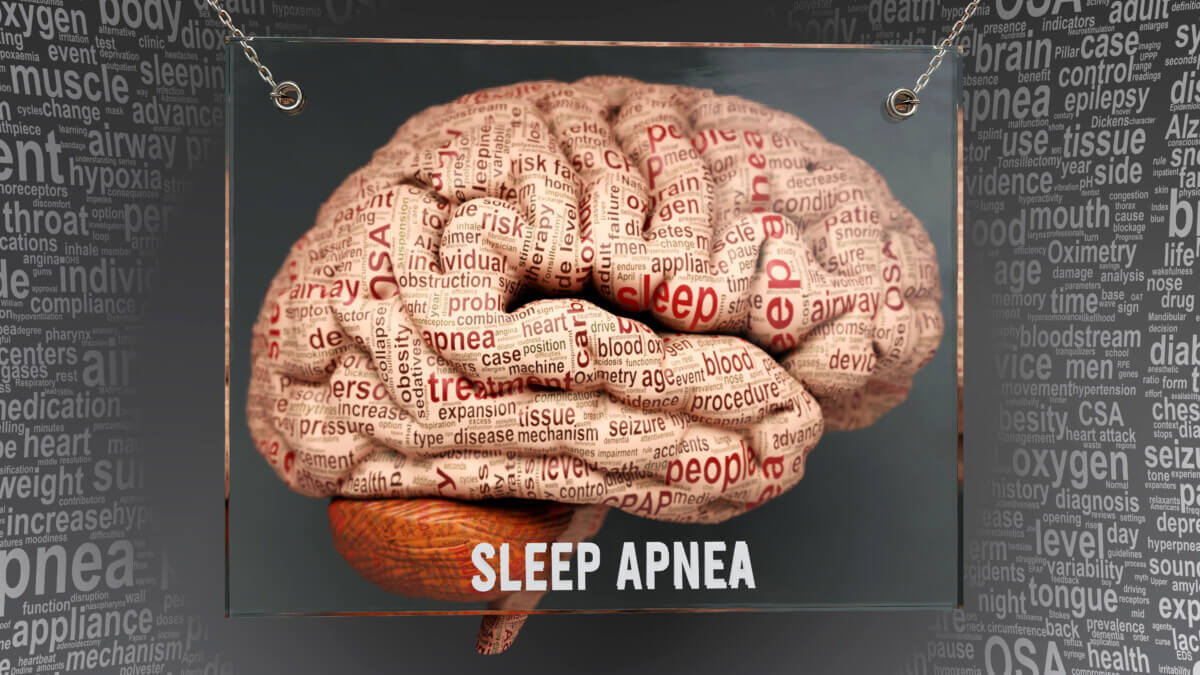 Sleep apnea brain anatomy