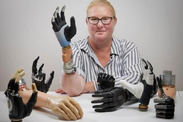 A highly integrated bionic hand in between many others.