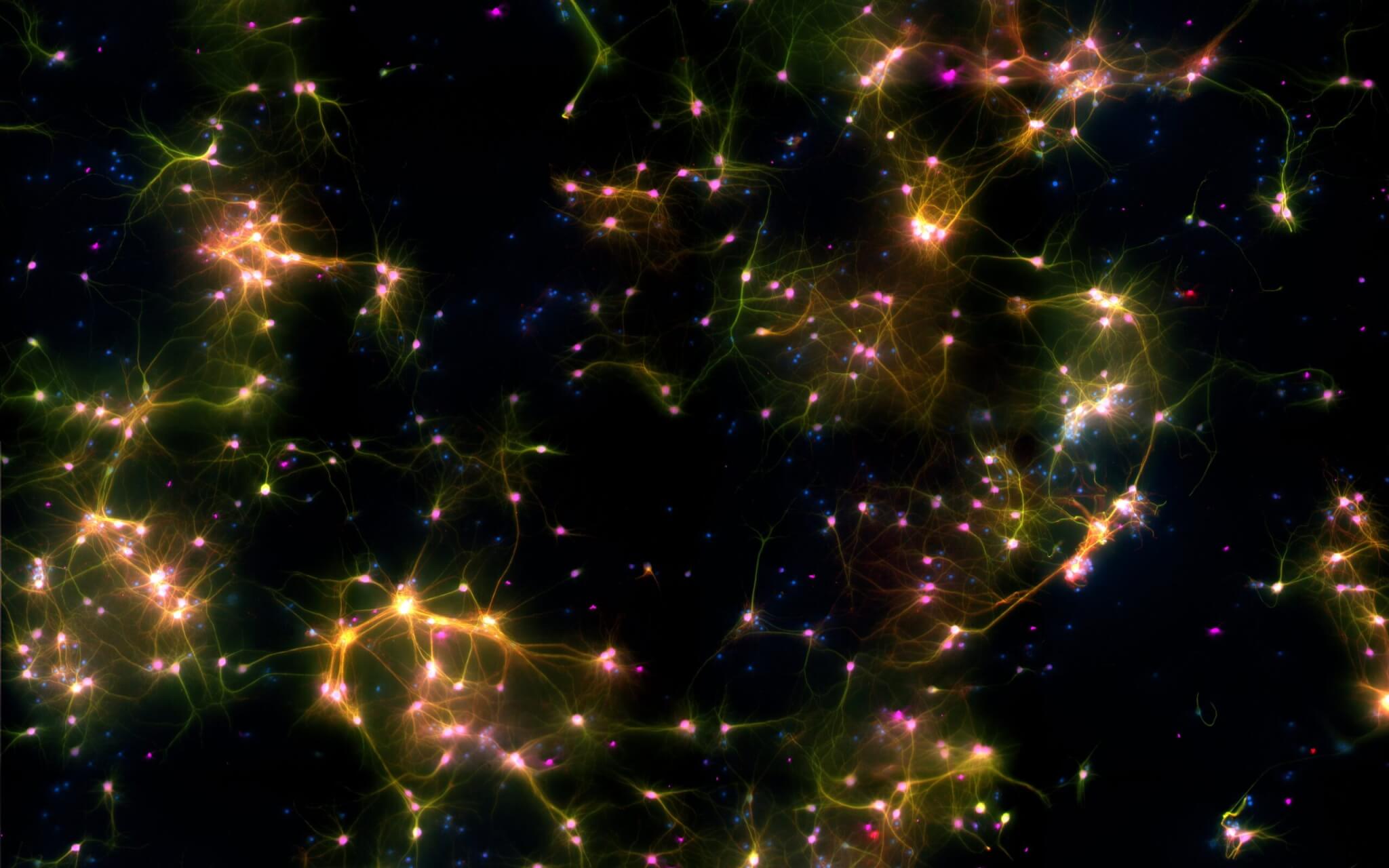 A microscopy image of neural cells where fluorescent markers show different types of cells. Green marks neurons and axons, purple marks neurons, red marks dendrites, and blue marks all cells