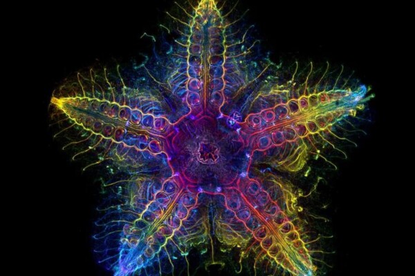 starfish nervous system