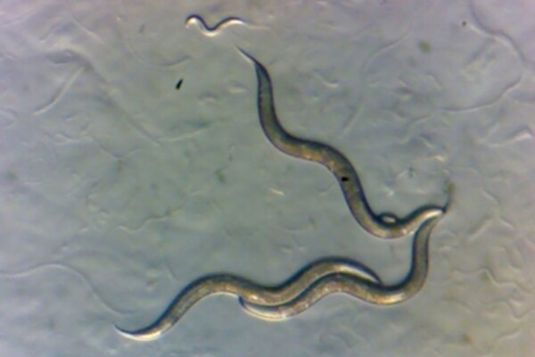 Worms collected in the Chornobyl Exclusion Zone, as seen under a microscope.