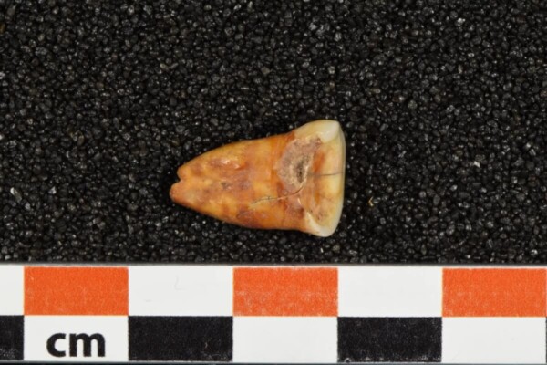 Human tooth from the Taforalt Cave in Morocco, showing severe wear and caries.