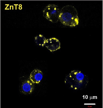 mAb43 (yellow) in beta cells. 