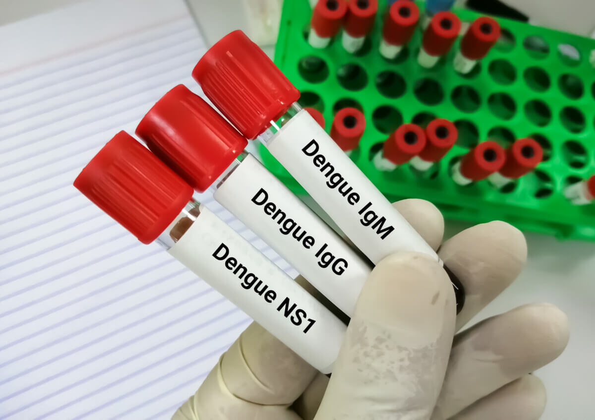 Antibody and antigen testing for dengue virus